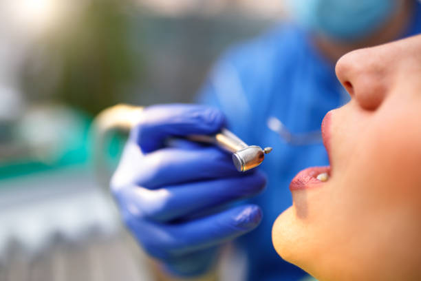 Trusted San Francisco, CA Dental Services Experts